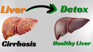 How To Liver Detox लिवर डिटॉक्स कैसे करें