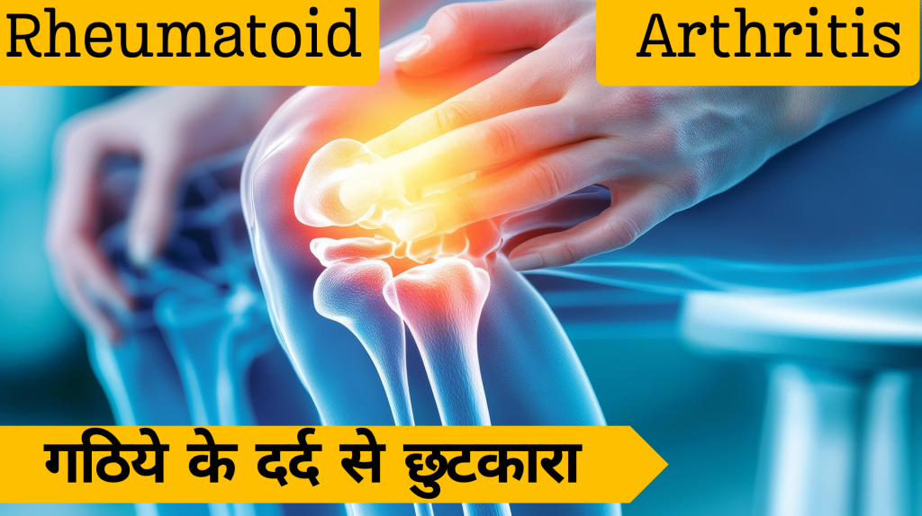 Current image: गठिये के दर्द से छुटकारा पाए get rid of arthritis pain